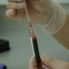 Categoría endocrinología - Evaluación endocrinológica-análisis de sangre-IMOBariatrica