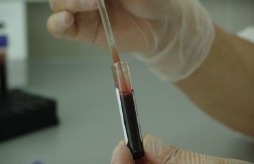 Evaluación endocrinológica-análisis de sangre-IMOBariatrica Categoría endocrinología - Evaluación endocrinológica-análisis de sangre-IMOBariatrica