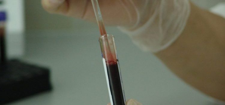Categoría endocrinología - Evaluación endocrinológica-análisis de sangre-IMOBariatrica