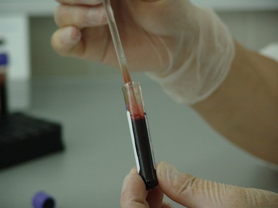 Evaluación endocrinológica-análisis de sangre-IMOBariatrica Categoría endocrinología - Evaluación endocrinológica-análisis de sangre-IMOBariatrica