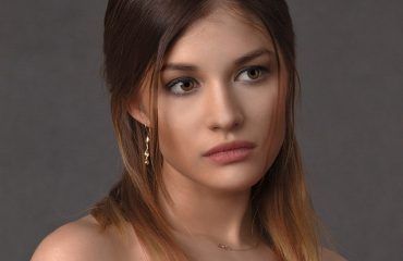 Caída del cabello-cirugía bariátrica-IMOBariátrica Caída del cabello-cirugía bariátrica-IMOBariátrica