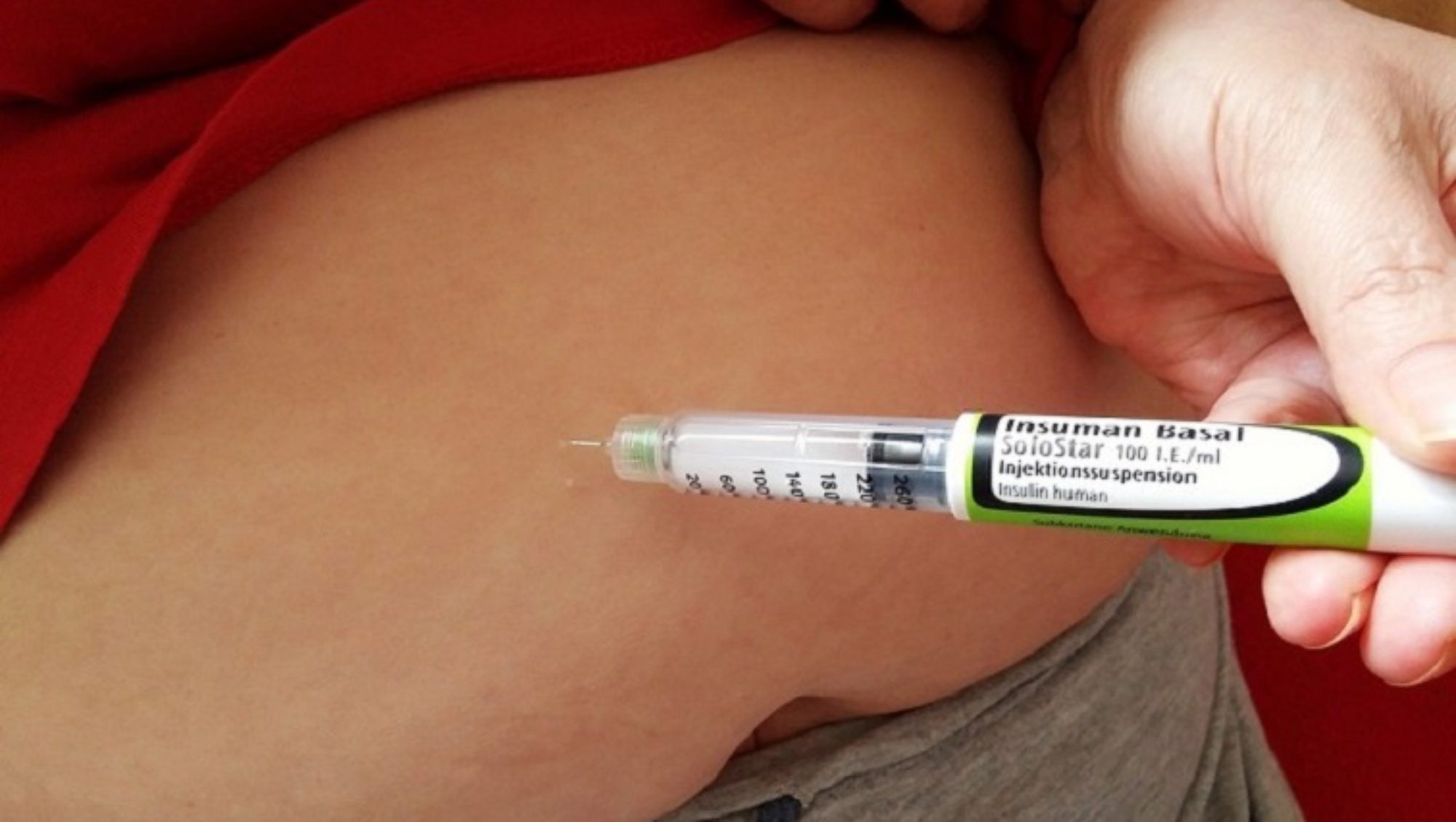 Diabesidad-Diabetes azúcar en sangre-IMOBariátrica Diabesidad-Diabetes azúcar en sangre-IMOBariátrica