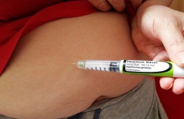 Diabesidad-Diabetes azúcar en sangre-IMOBariátrica Diabesidad-Diabetes azúcar en sangre-IMOBariátrica