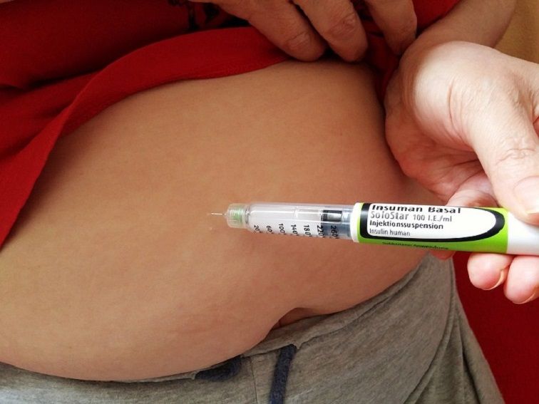 Diabesidad-Diabetes azúcar en sangre-IMOBariátrica Diabesidad-Diabetes azúcar en sangre-IMOBariátrica