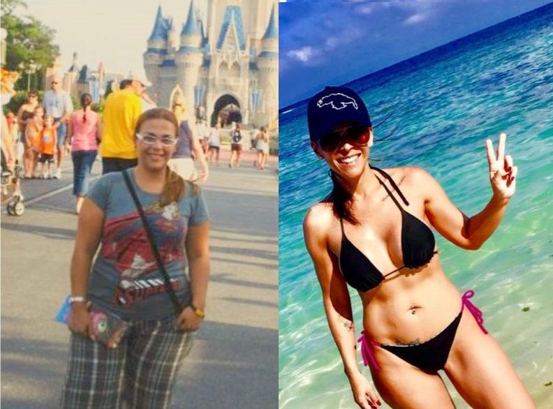 Bariátrica - Cirugías - Testimonios -IMOBariatrica- Sokaris Duarte