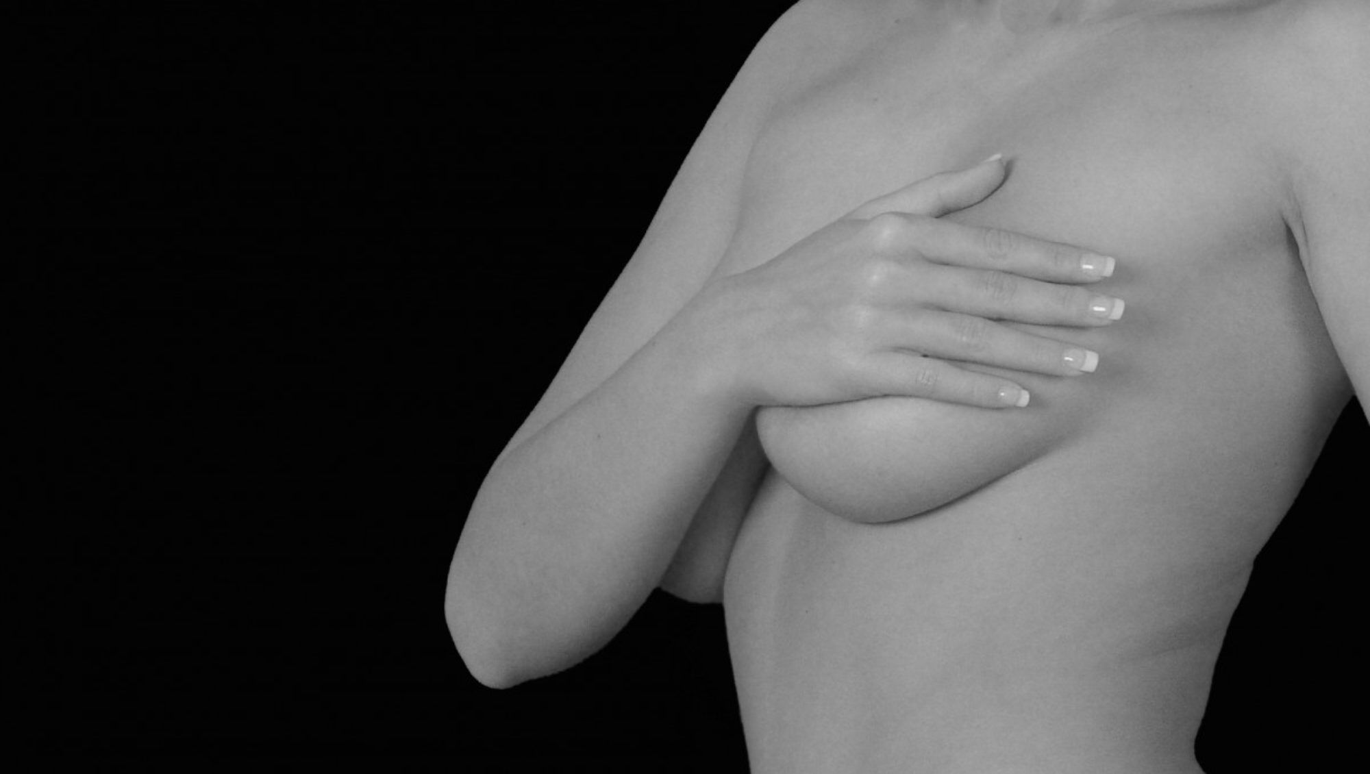 Mastopexia-mamoplastia-IMOBariatrica Mastopexia-mamoplastia-IMOBariatrica