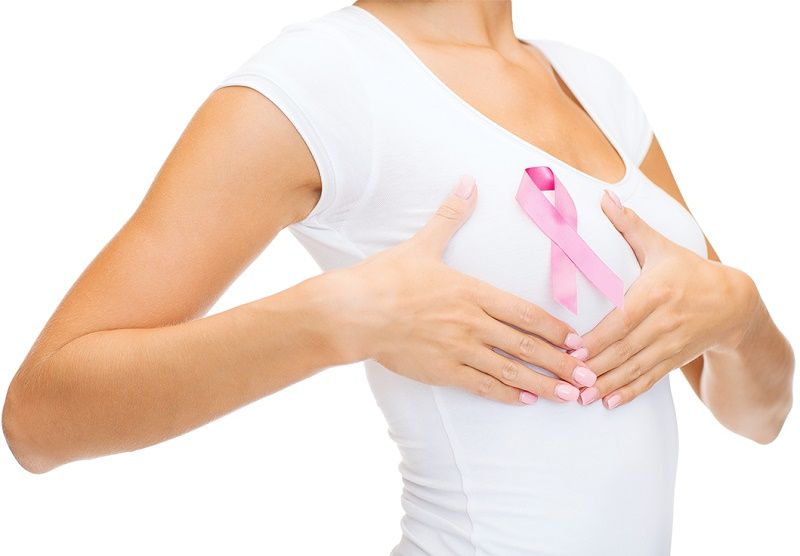 Obesidad - Cáncer de mama - IMOBariátrica