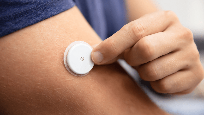 Glucosa Dispositivo monitoreo tipo parche - IMOBariátrica