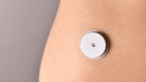Glucosa - diabetes y obesidad - IMOBariátrica